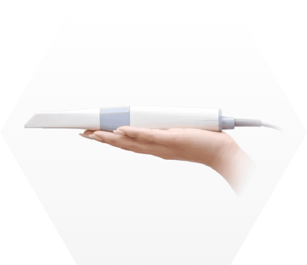 メリット4のフォト画像