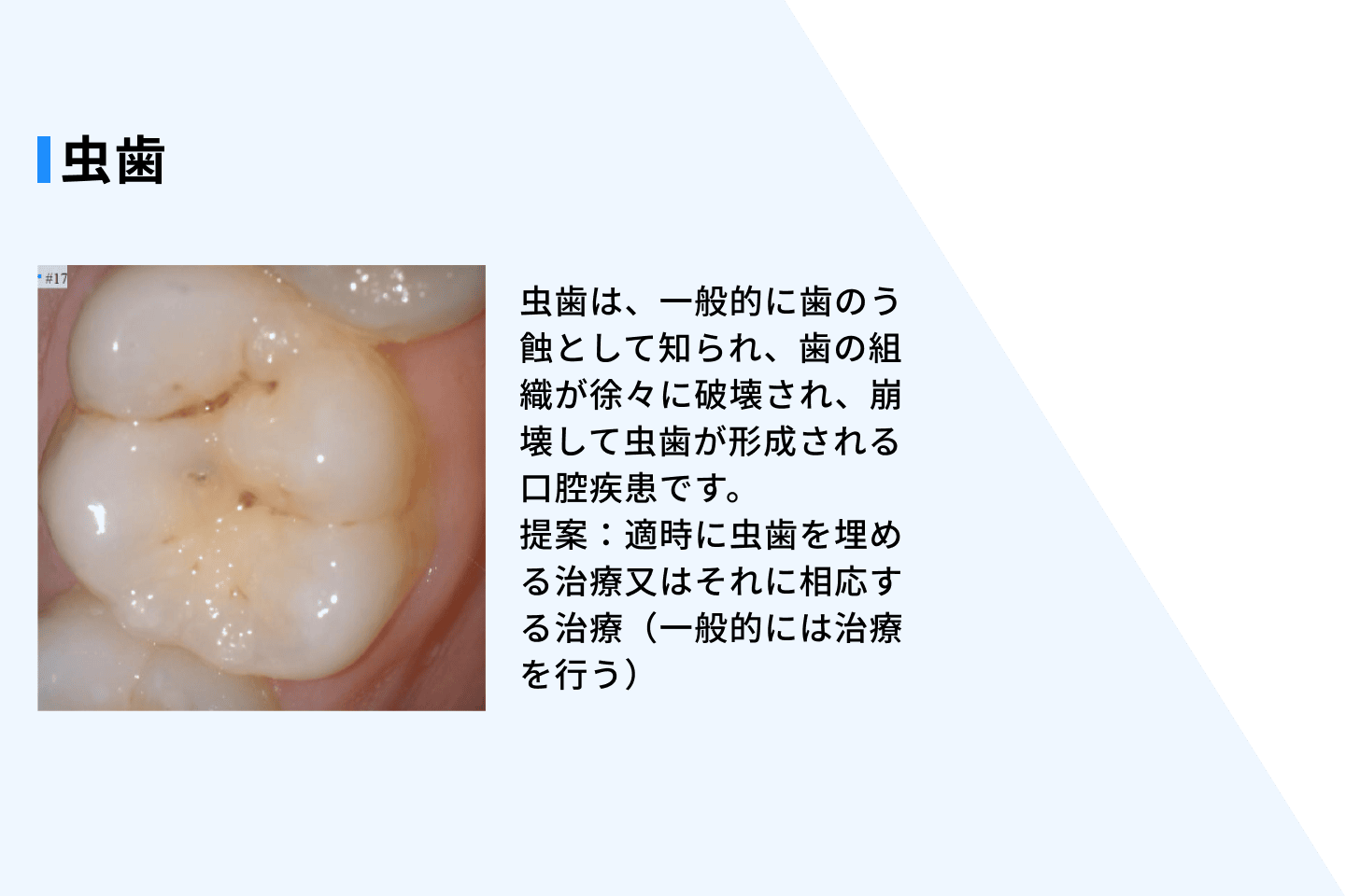 オーラルヘルスレポートのイメージ2