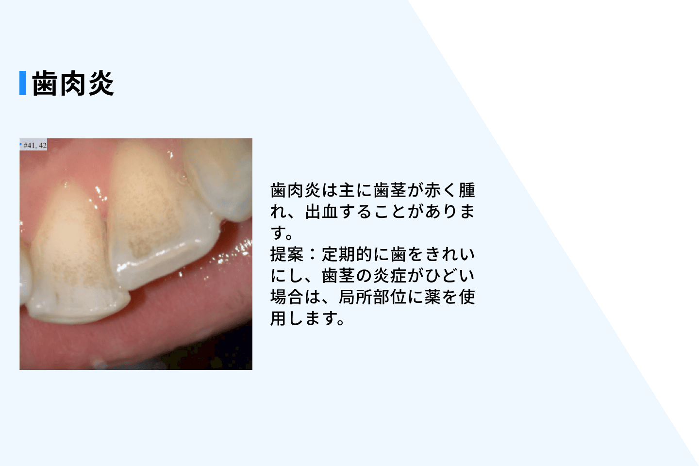 オーラルヘルスレポートのイメージ2